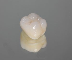 Single dental crown sitting atop a mirrored background