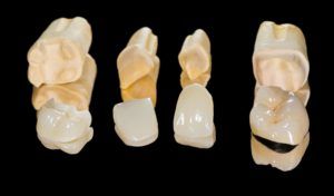 Dental restorations lying next to each other on a black background