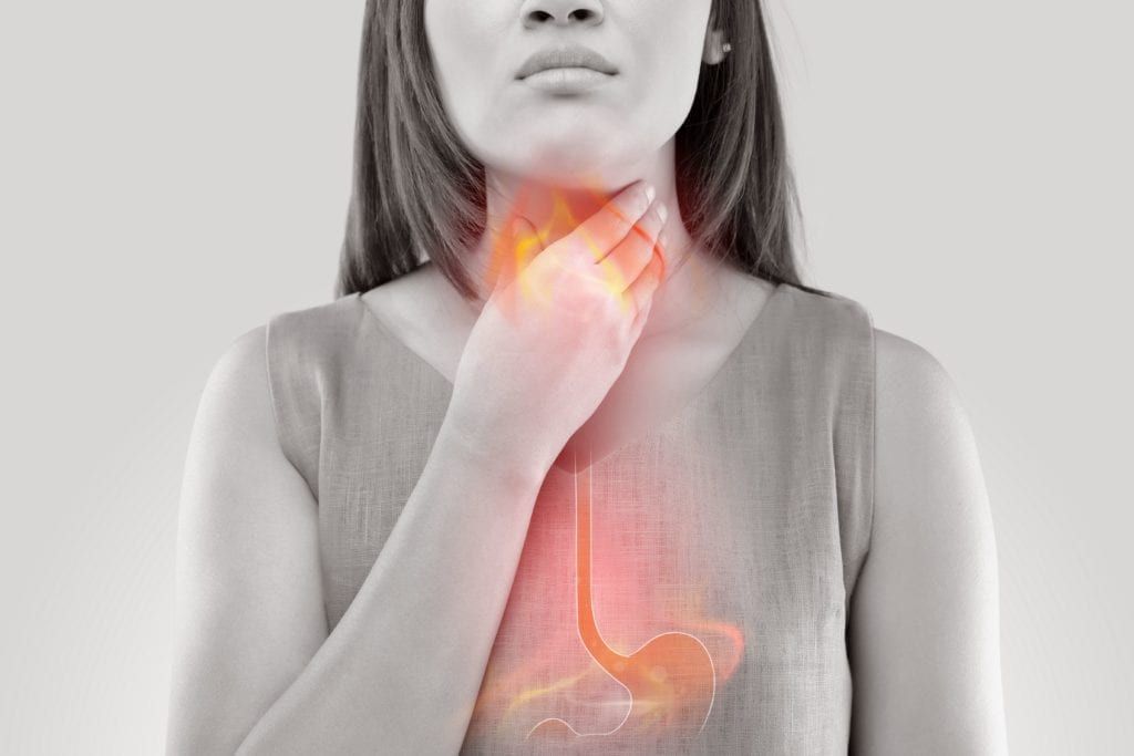 woman with acid reflux