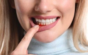 Woman pulling down lip to reveal gum disease